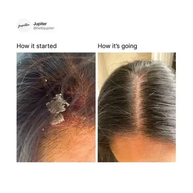 Jupiter — How It Started / How It's Going