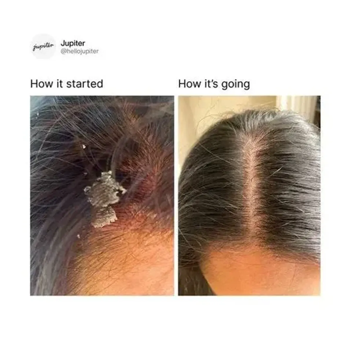 Jupiter — How It Started / How It's Going